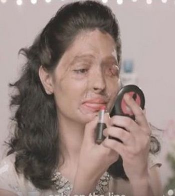 Συγκινητικό!! Γυναίκα θύμα επίθεσης με οξύ παραδίδει μαθήματα μακιγιάζ!! (βίντεο)