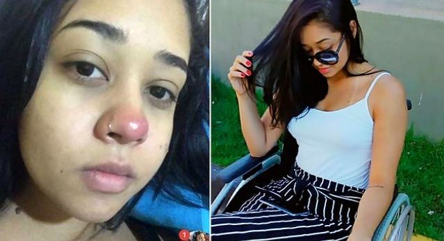 nose piercing wheelchair